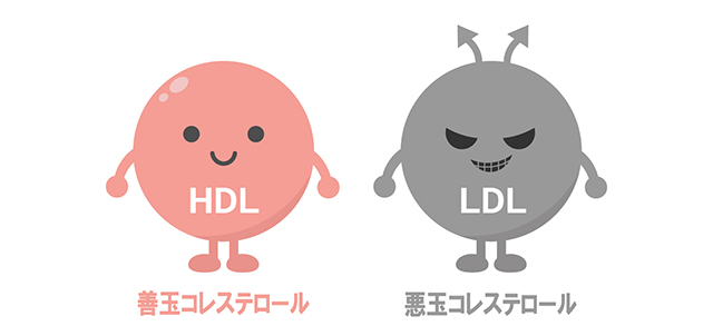 脂質異常症|沈黙の動脈硬化を進行させる危険因子