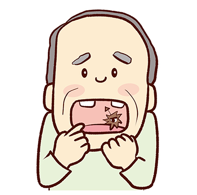 清潔な入れ歯を維持する意味